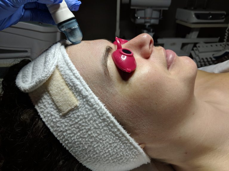On a testé pour vous : la cure de microdermabrasion